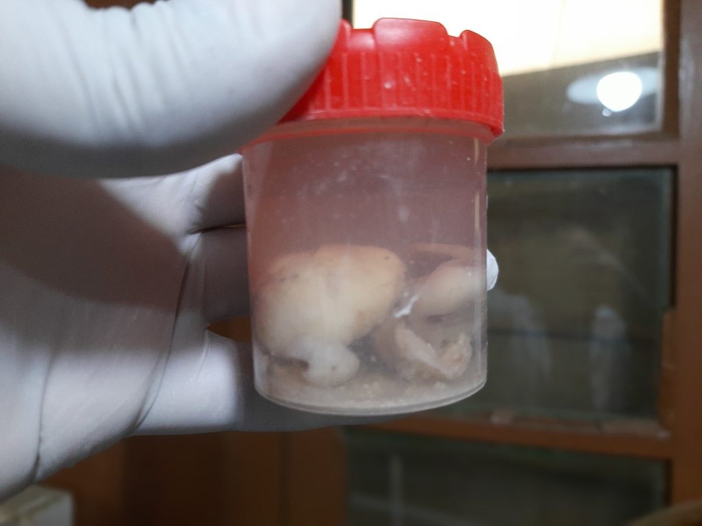 Gewebebiopsie in Formalin