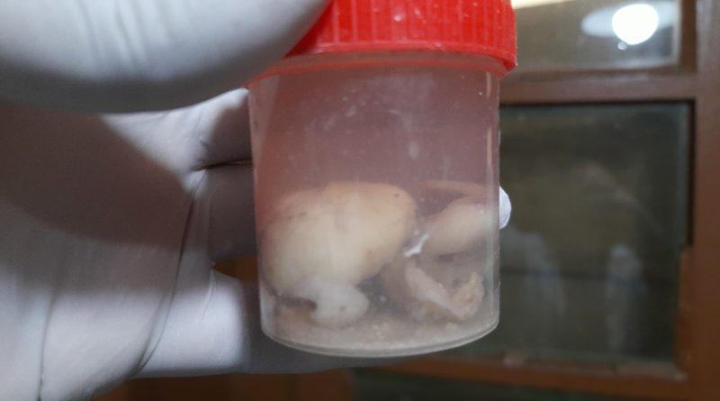 Gewebebiopsie in Formalin